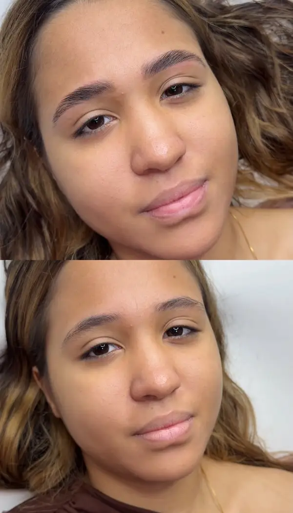 Antes e depois do brow lamination