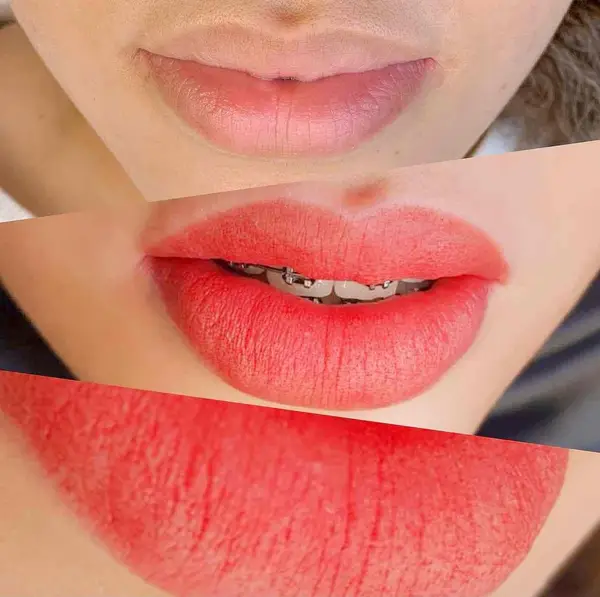 Antes, durante e depois da micropigmentação labial